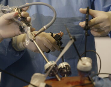 Laparoscopy vs. Hysteroscopy: Understanding the Difference and When Each Is Used