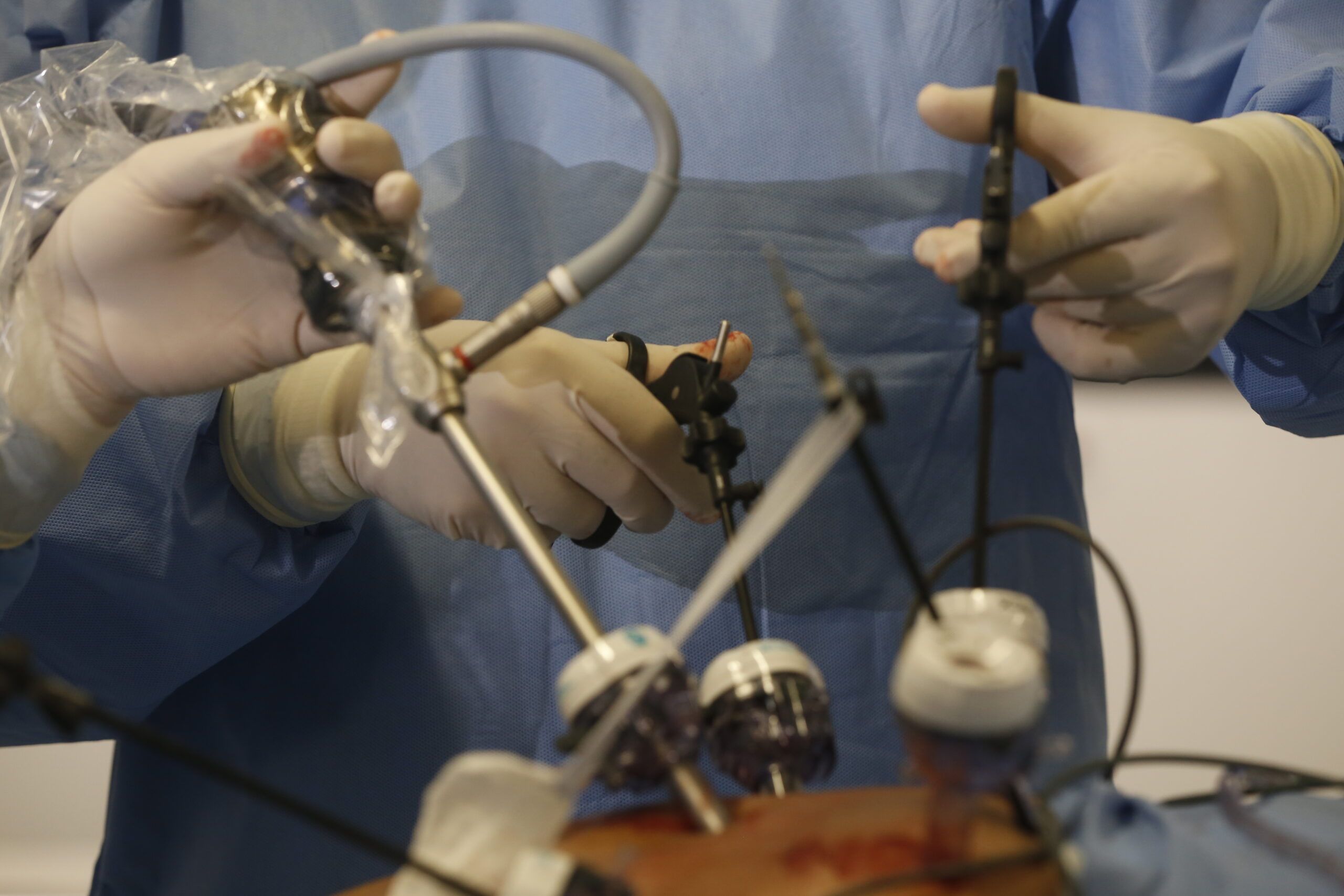 Laparoscopy vs. Hysteroscopy: Understanding the Difference and When Each Is Used