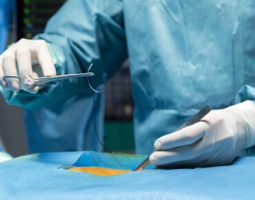 Laparoscopic colorectal surgery in Trivandrum